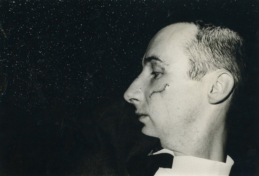 24 Marcia Resnick (photographer), Portrait of Vict